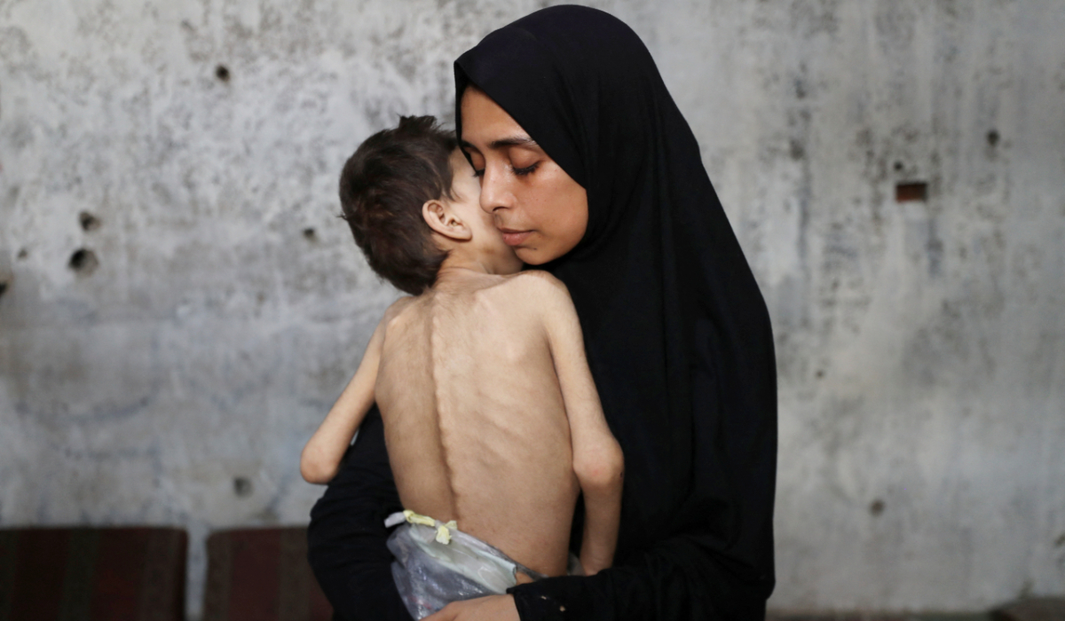 Displaced Palestinian mother Samah Matar holds her malnourished son Youssef, who suffers from cerebral palsy, at a school where they shelter amid a hunger crisis, in Gaza City, July 24, 2025. (REUTERS)