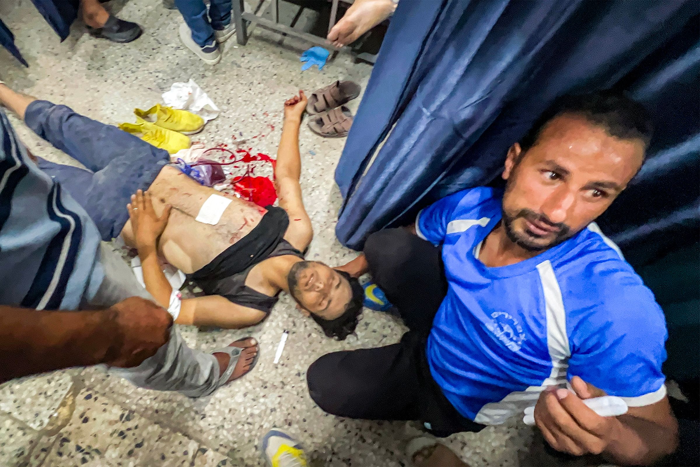 A Palestinian man awaits treatment at Shifa hospital after he was injured while waiting for aid trucks entering the northern Gaza Strip through the Zikim crossing. (AFP)