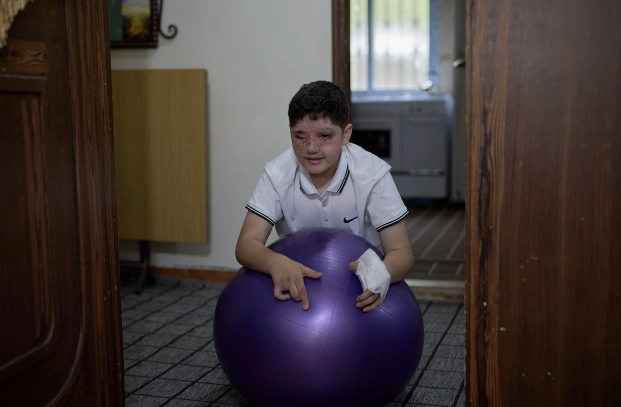 Ali Abbas, 11, who was wounded in the pagers attack carried out by Israel on Sept. 17, 2024, plays at his parents' house in the village of Barish, southern Lebanon, Monday, April 28, 2025. (AP)