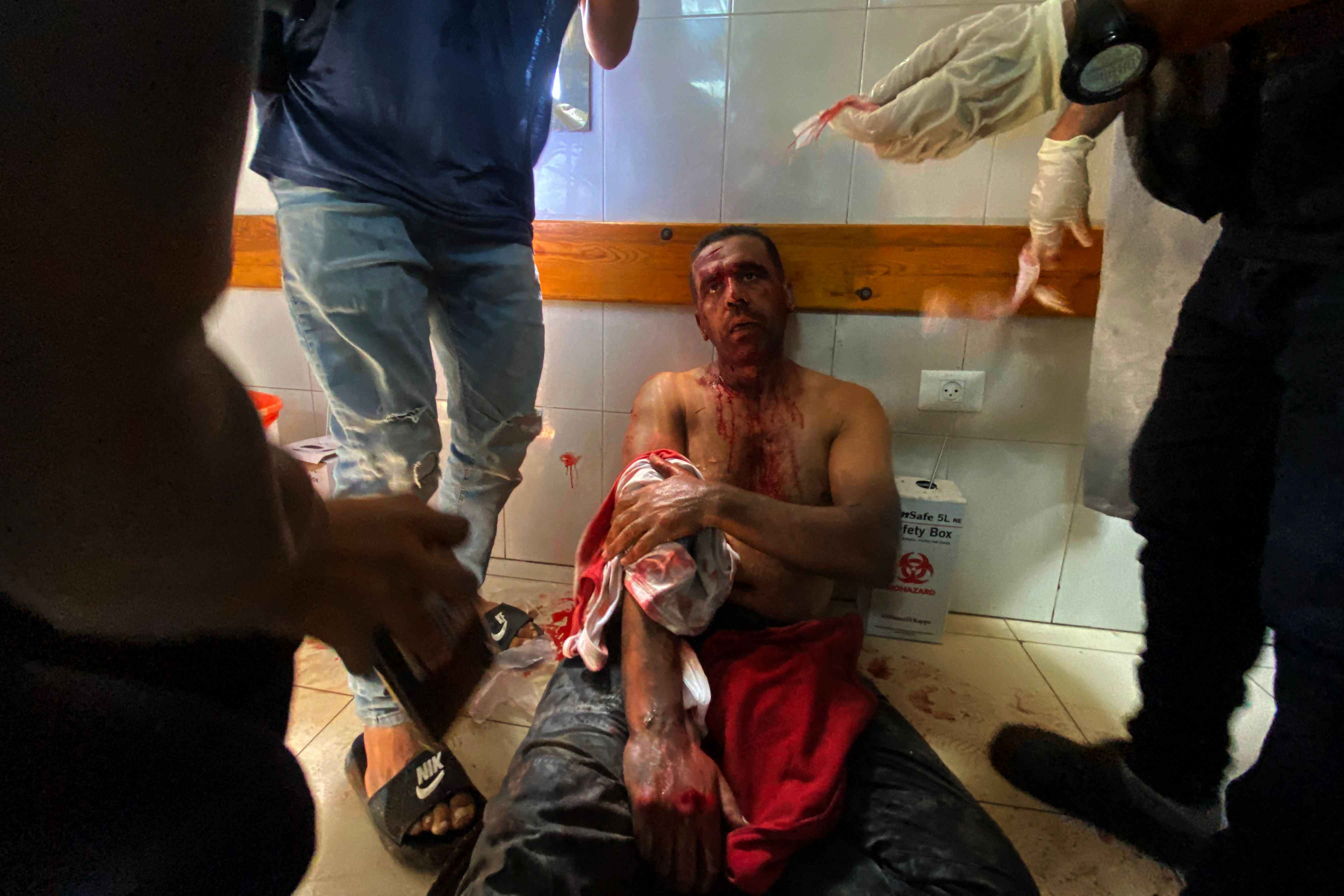 Palestinian photojournalist Hatem Omar waits for treatment after being injured in an Israeli strike on Nasser Hospital in Khan Yunis, in the southern Gaza Strip, on August 25, 2025. (AFP)