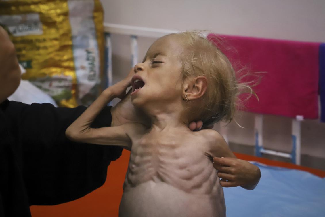 More than half a million people in Gaza, a quarter of the population, are experiencing catastrophic levels of hunger because of the blockade and ongoing military operations. (AP)