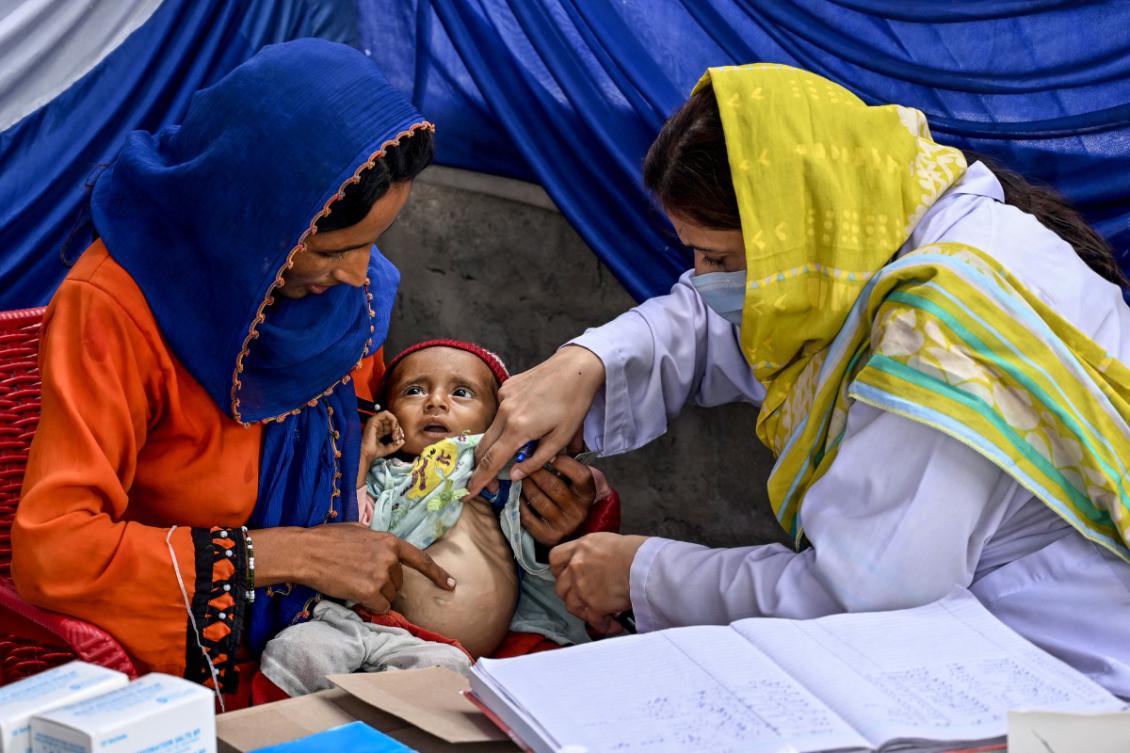 Malnutrition causes unrecognized type of diabetes: experts