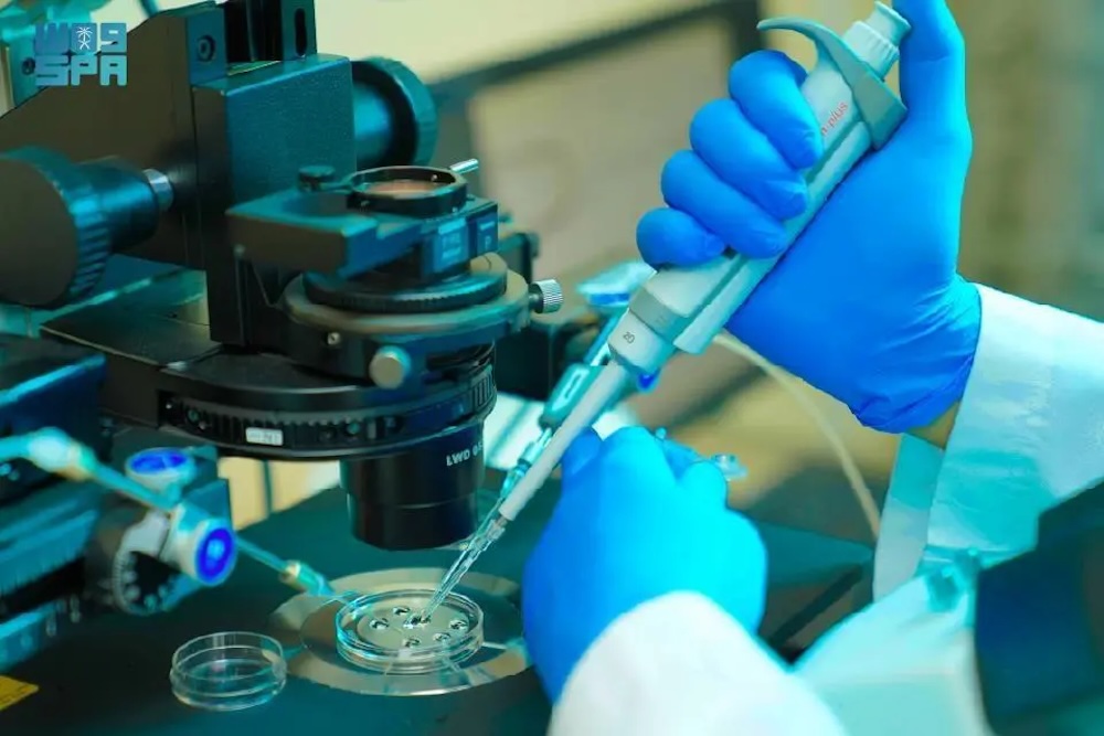 King Faisal Specialist Hospital and Research Centre in Madinah has performed the first allogeneic stem cell transplant for a patient diagnosed with acute myeloid leukemia. (SPA)