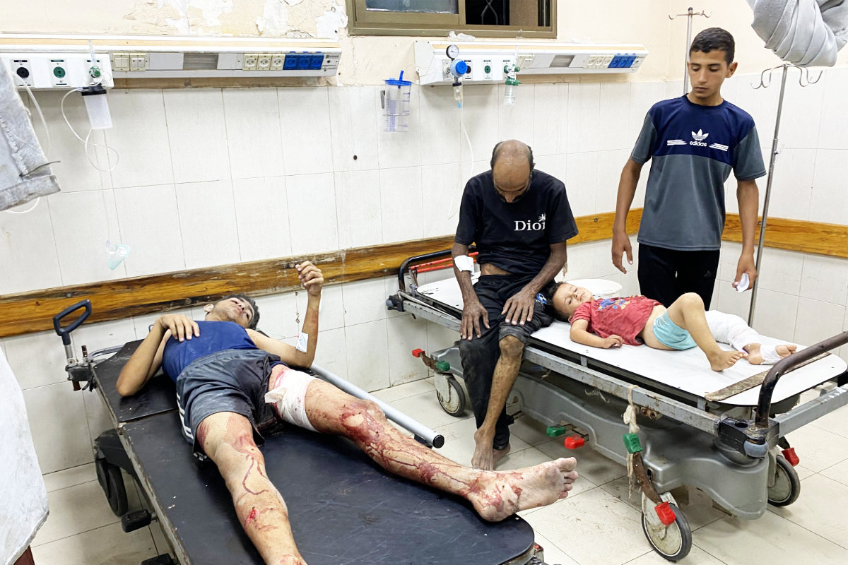 Injured children wait for treatment at Nasser Medical Complex in Khan Yunis in the southern Gaza Strip on July 28, 2025, following Israeli bombardment on the Mawasi area of Khan Yunis. (AFP file photo)