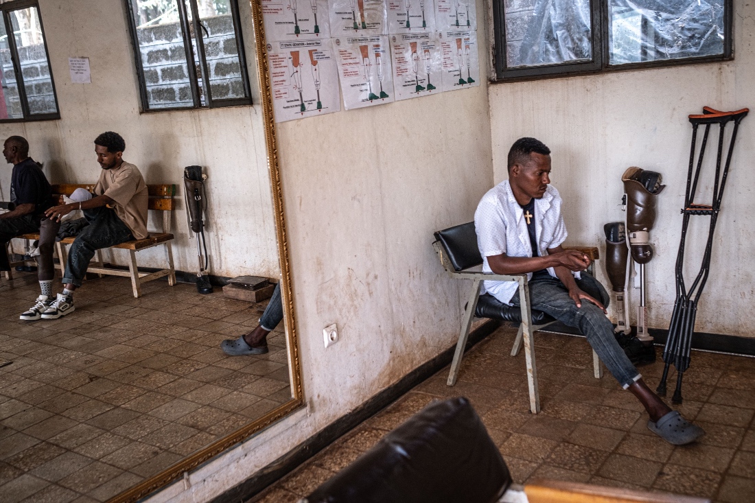 Belete Melke, a farmer who was caught in crossfire during the last rainy season in an area about six hours from Bahir Dar, waits for his turn to begin physiotherapy in Amhara, Ethiopia. (AFP)