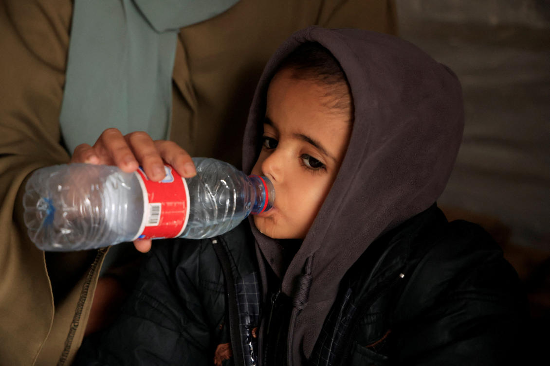 Displaced Palestinian child Yasser Arafat, 5, who, according to medics, suffers from severe acute malnutrition with nutritional edema, drinks water inside their family’s tent at a displacement camp in Khan Younis, southern Gaza Strip, December 16, 2025. (Reuters)