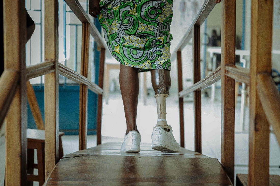 A patient tests her new prosthesis at the Shirika la Umoja centre in Goma, Congo. (AFP)
