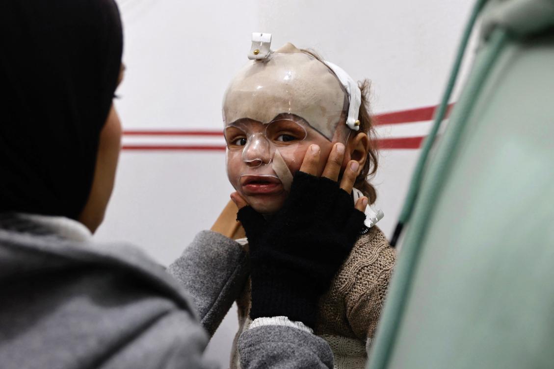 A child wearing a protective perspex mask arrives at the Doctors Without Borders (MSF) clinic in Gaza City on Wednesday. The charity is among 37 aid organizations that will be banned from operating in Gaza from January 1. (AFP)