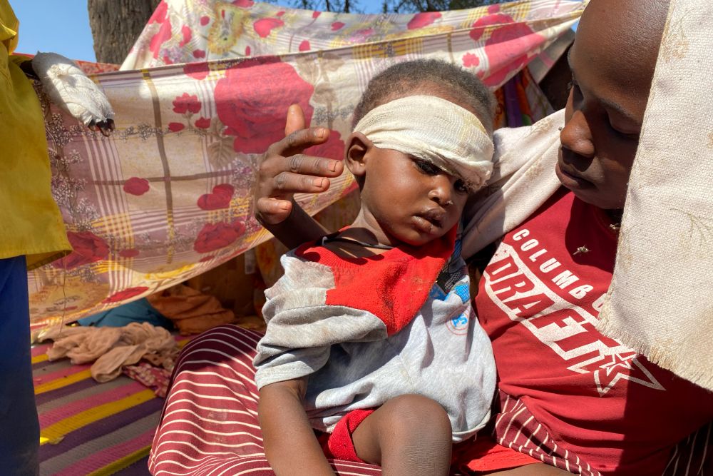 A Sudanese child, who fled El-Fasher city with family after Sudan’s paramilitary forces attacked the western Darfur region, receives treatment at a camp in Tawila, Sudan, Nov. 2, 2025. (AP Photo)