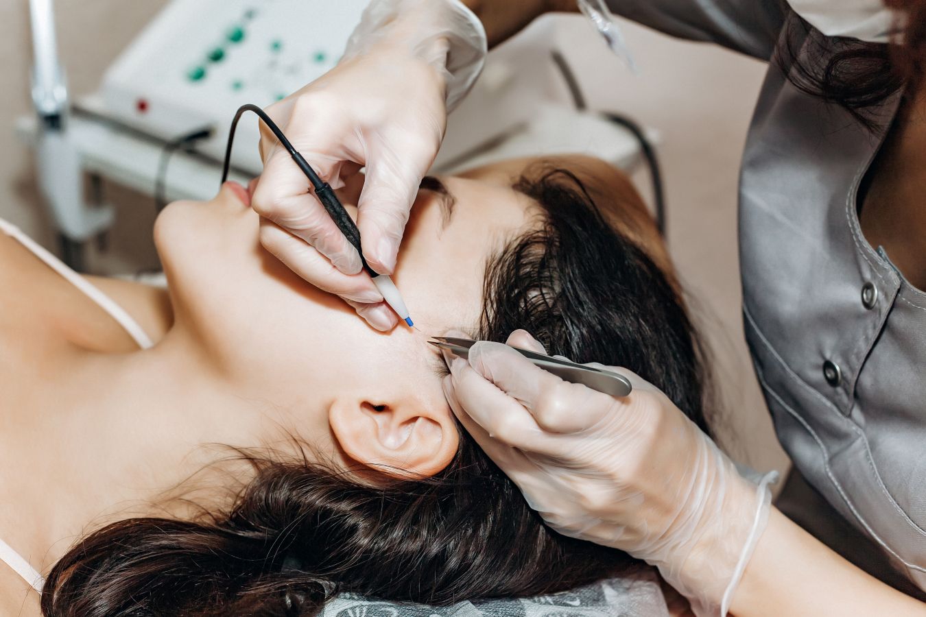 Laser has dominated the conversation for years, and electrolysis, which requires more sessions and a licensed electrologist’s precision, has struggled to break through. (Shutterstock)