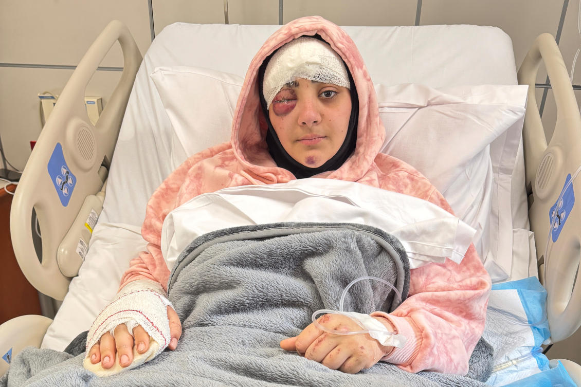 Photographer Zeinab Faraj, who was wounded in an Israeli airstrike that killed her colleague this week, recovers in Al-Zahraa hospital in Beirut on Friday. (AP)