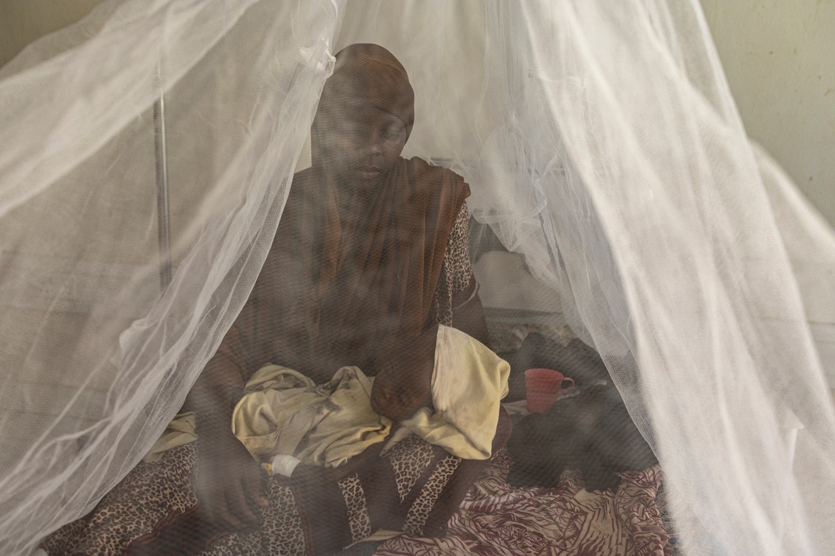 A newly displaced Somali woman holds her severely malnourished baby in a stabilization centre for children suffering severe accute malnutrition in Kismayo, Somalia. (AFP)