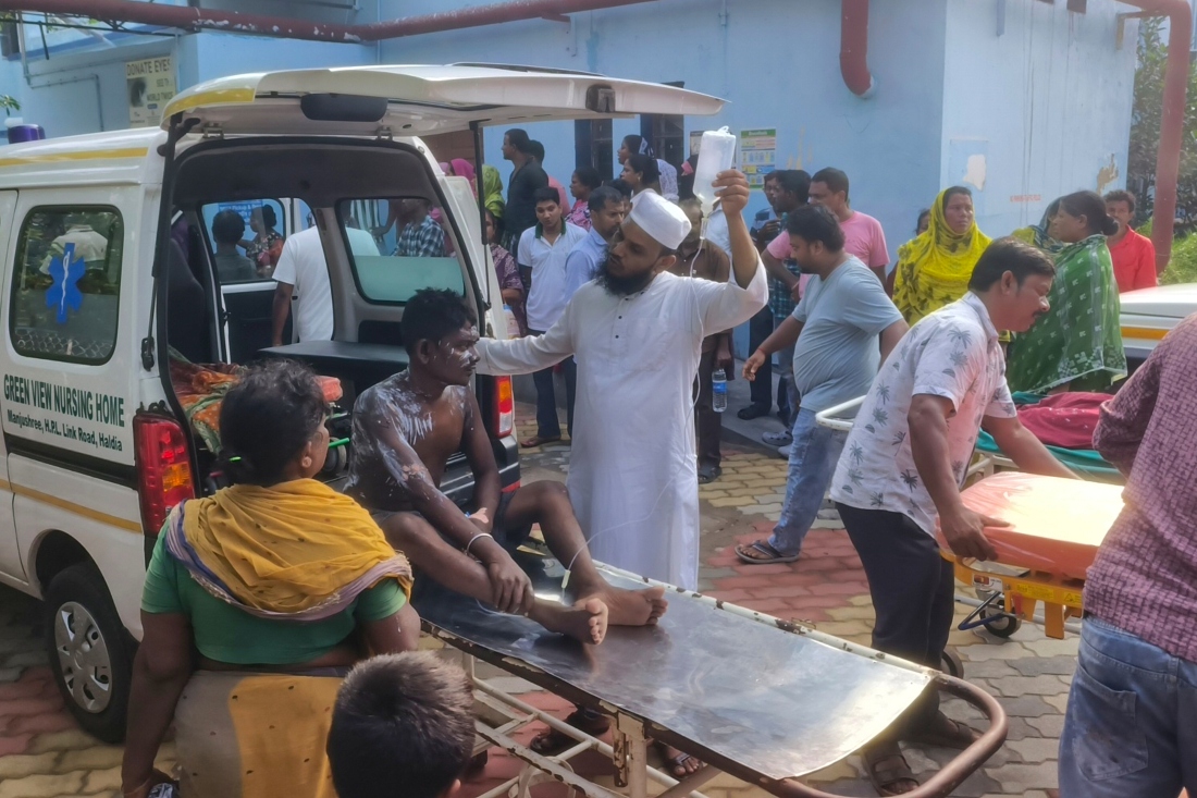A victim of a fire at a petrochemical plant is brought to a hospital for treatment in Purba Medinipur district, India. (AP)