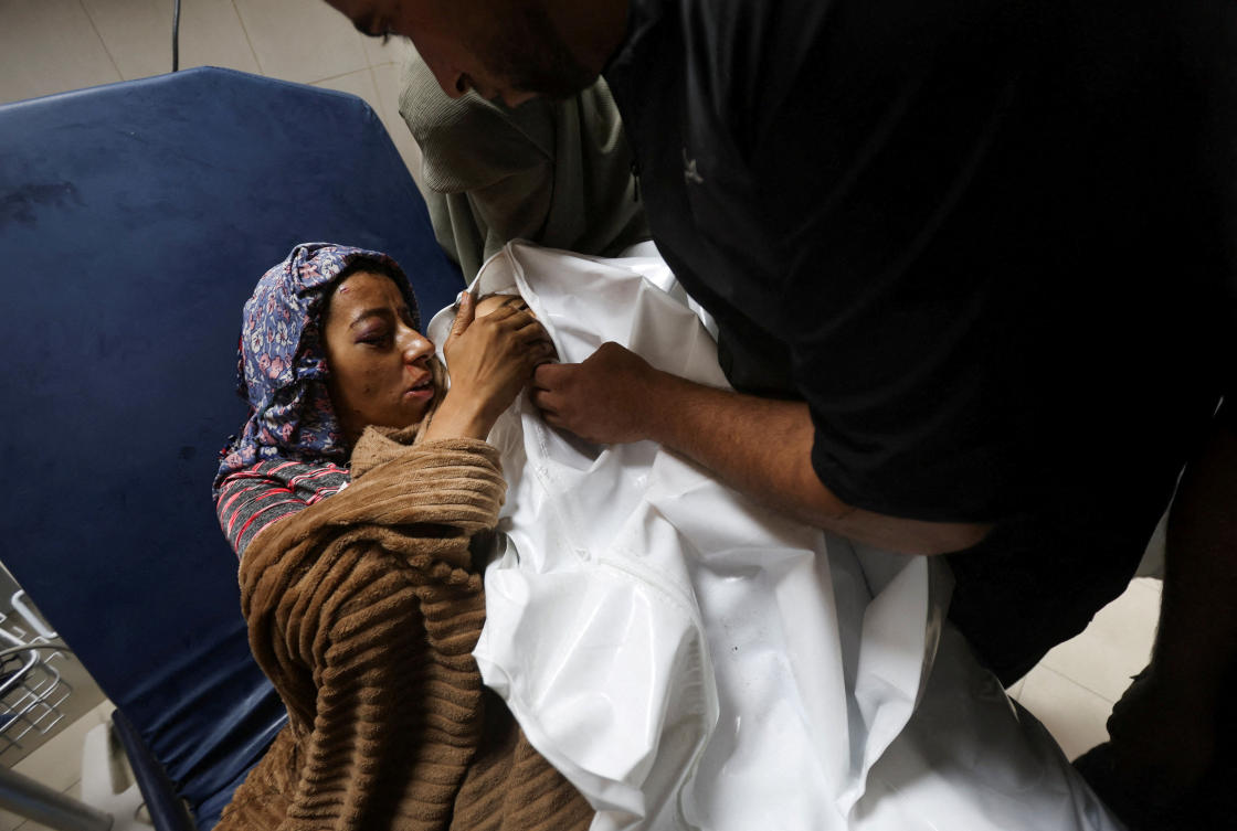 Injured Duaa Al-Balawi lies in a hospital bed as she bids farewell to her daughter Rateel, who was killed in an Israeli strike on a tent, according to medics, at Nasser Hospital in Khan Younis, in the southern Gaza Strip on July 30, 2026. (Reuters)