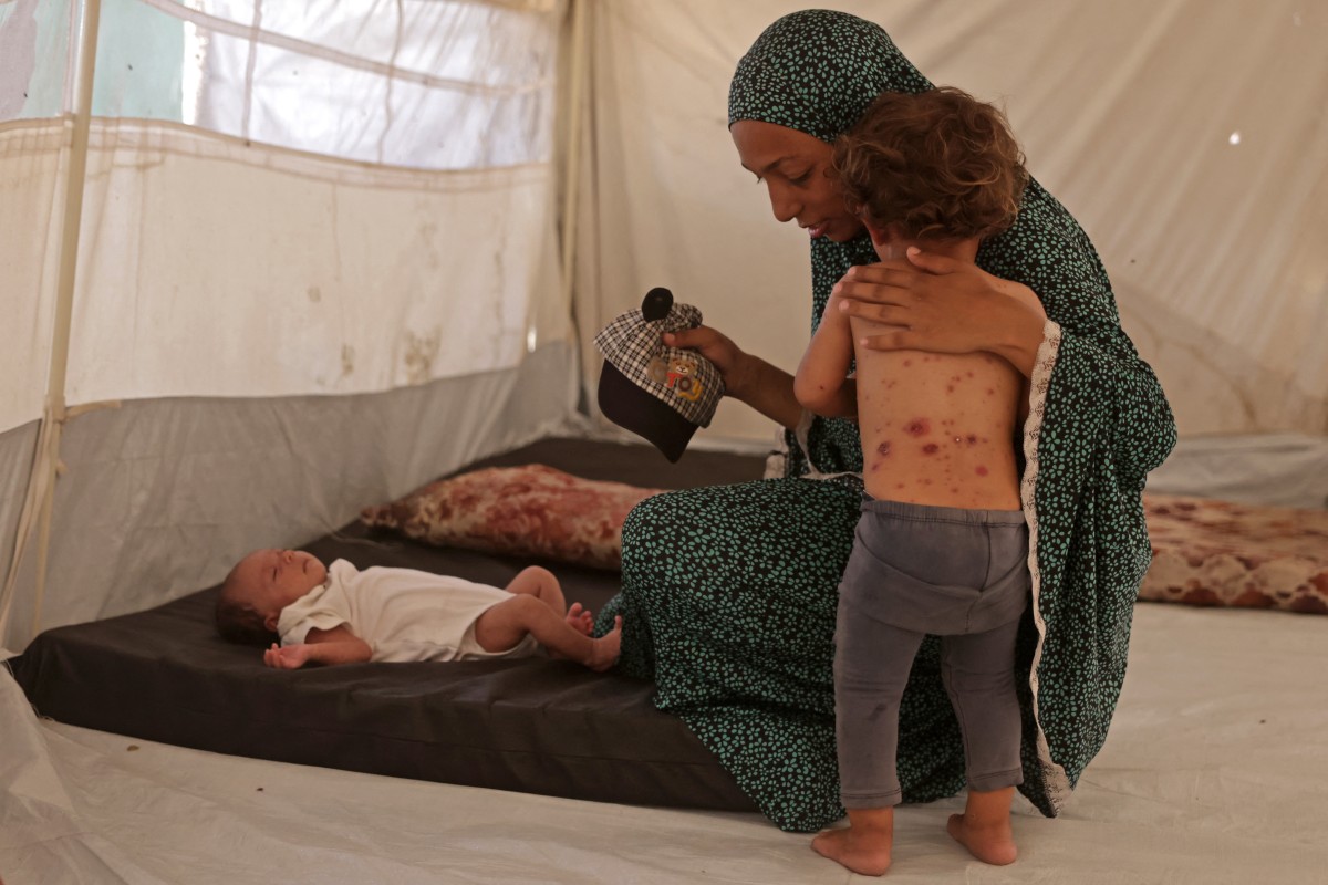 A displaced Palestinian girl, who according to doctors is suffering from chickenpox, stands next to her mother inside the family's tent in Khan Yunis, in the southern Gaza Strip, on July 19, 2026. (File/AFP)