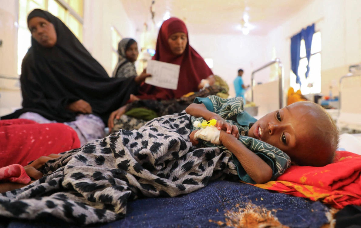 MSF says half of displaced children in southwest Somalia acutely malnourished
