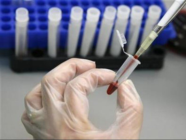 During a screening exercise, a laboratory technician examines blood samples for HIV/AIDS. (Reuters)