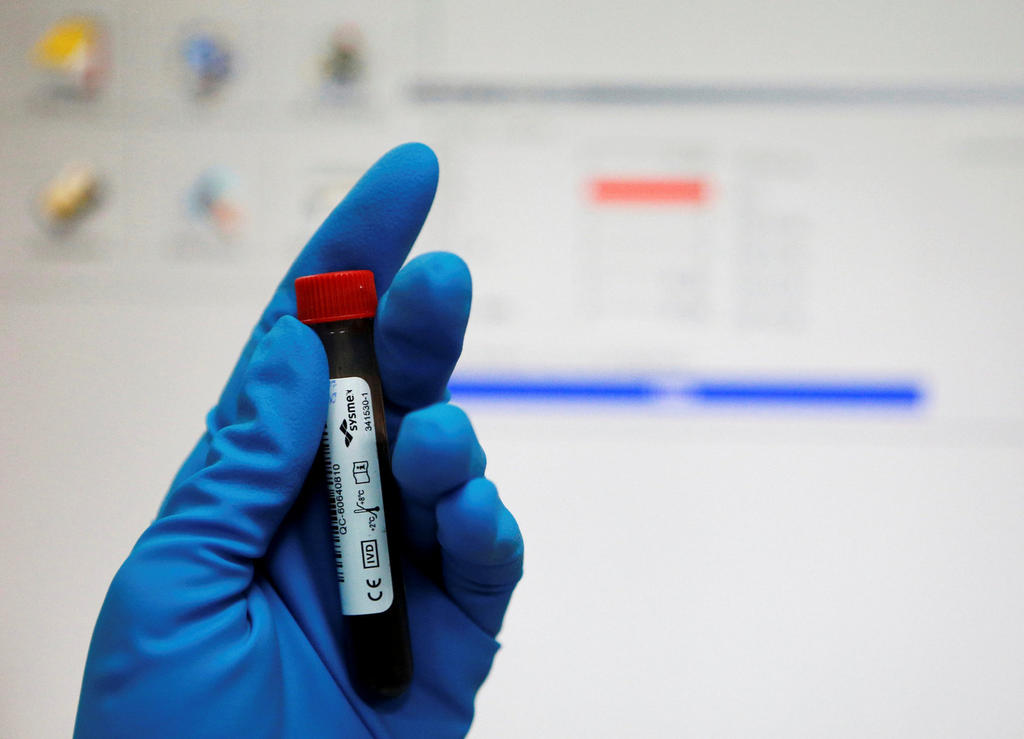 In this file photo a technician holds a test tube with a blood sample at anti-doping laboratory. (REUTERS / FILE)