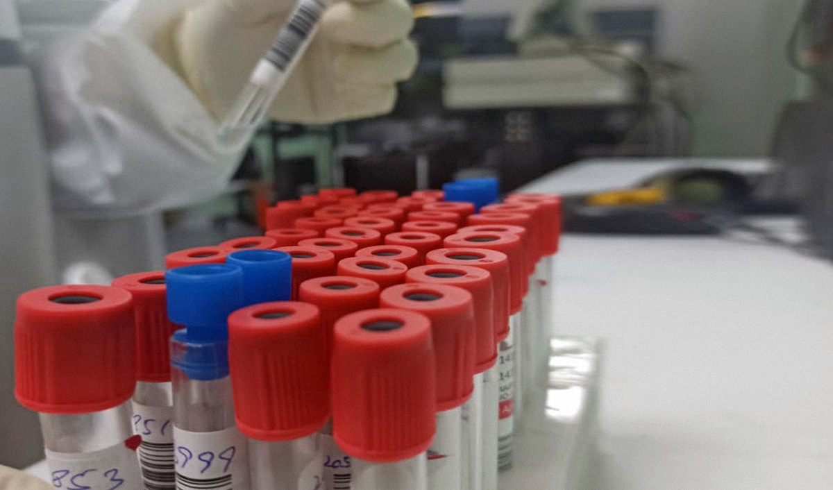 Vials with samples for coronavirus testing are seen at the Public Health Reference Laboratory in Lahore on April 23, 2020. (AN photo by Natasha Zia)