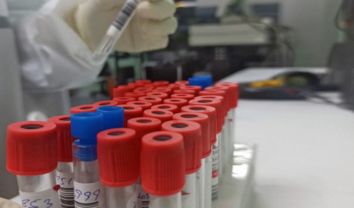 Vials with samples for coronavirus testing are seen at the Public Health Reference Laboratory in Lahore on April 23, 2020. (AN photo by Natasha Zia)