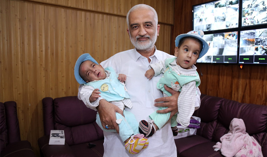 In this undated photo, previously conjoined Pakistani twins, Muhammad Ayan and Muhammad Aman, are held by Mr. Sarim Burney, Chairman of the Sarim Burney Trust. (Photo by Sarim Burney Trust)