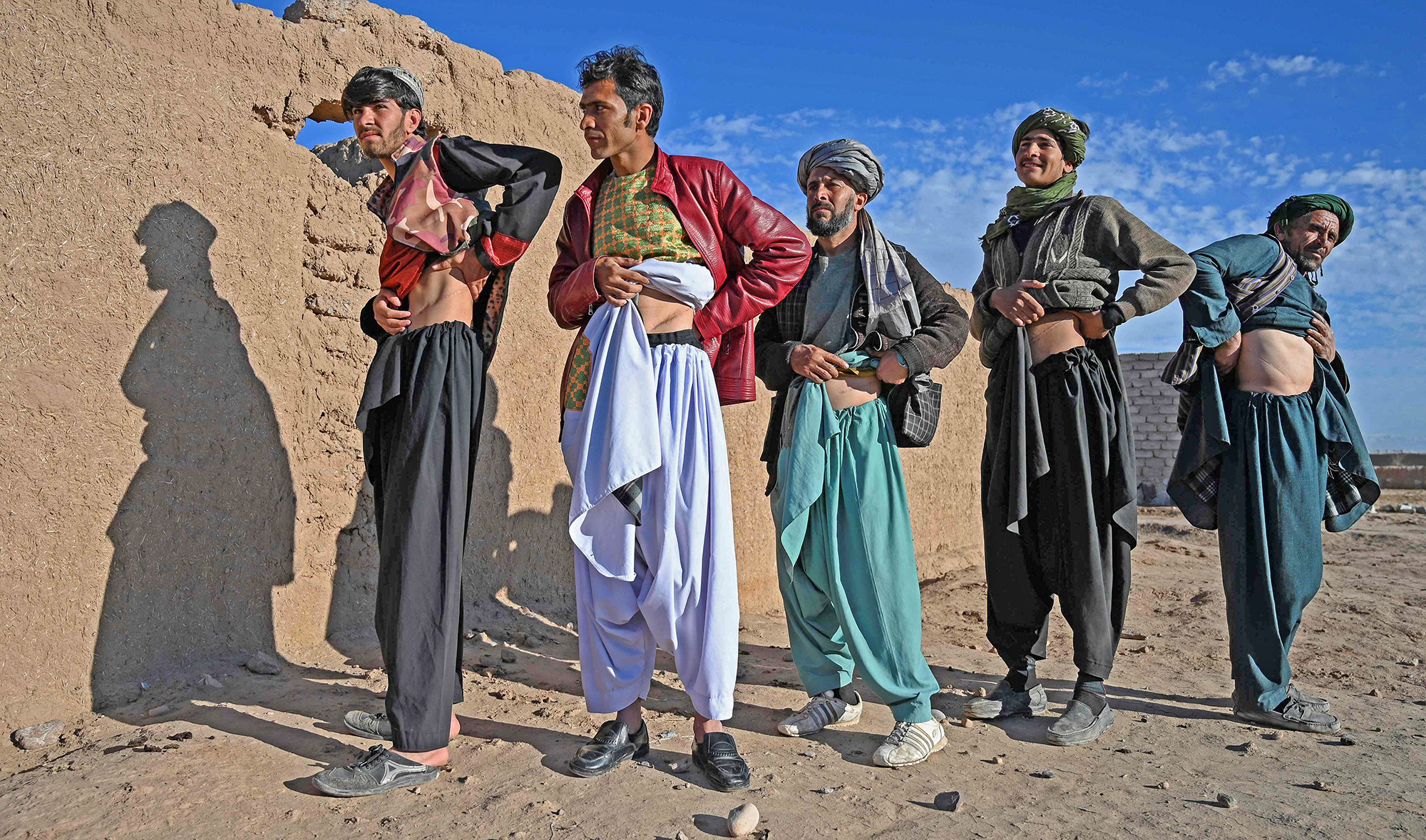 Afghan men who sold their kidneys over a period of the last four years pose for a picture showing their scars from the operation at Sayshanba Bazaar in the Injil district of Herat province on February 4, 2022. (AFP)