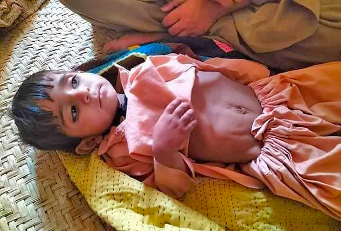 A young boy suffering from cholera is treated at a basic health unit in Pir Koh, a village near Dera Bugti in Pakistan’s Balochistan province, on May 11, 2022. (Photo courtesy: Wadera Qadir Bugti)