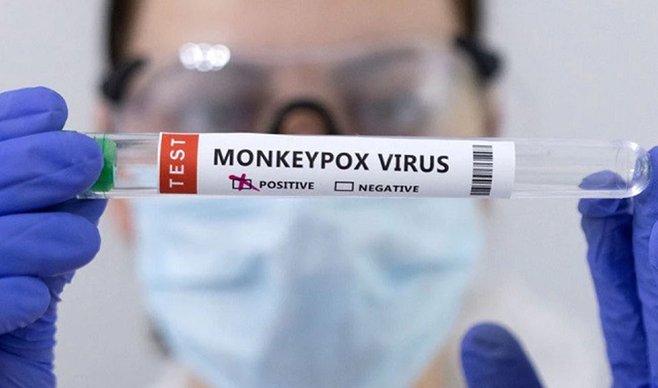 Test tubes labelled 'Monkeypox virus positive' are seen in this photo taken on May 23, 2022. (Photo courtesy: Reuters)