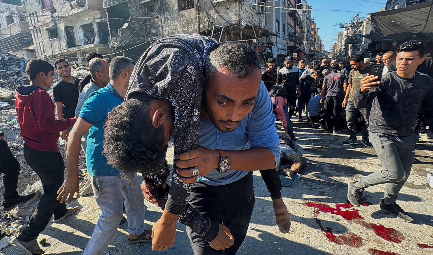 A Palestinian carries an injured person following an Israeli strike, amid the Israel-Hamas conflict, in Beit Lahiya in the northern Gaza Strip on October 30, 2024. (REUTERS)