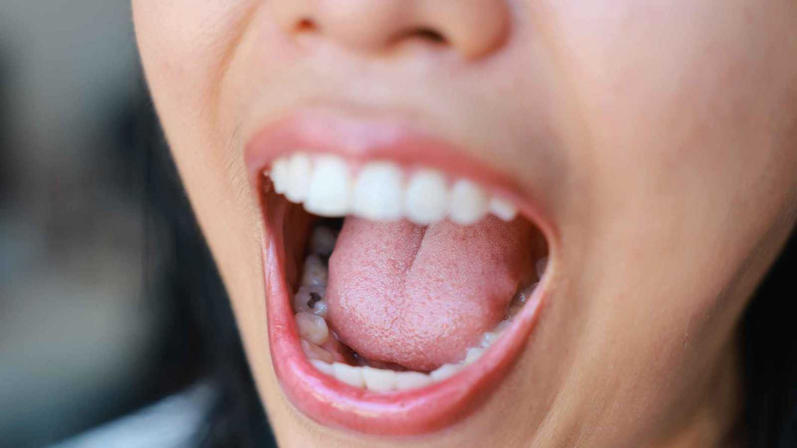 بكتيريا اللسان ترتبط بسرعة معالجة المعلومات في الدماغ