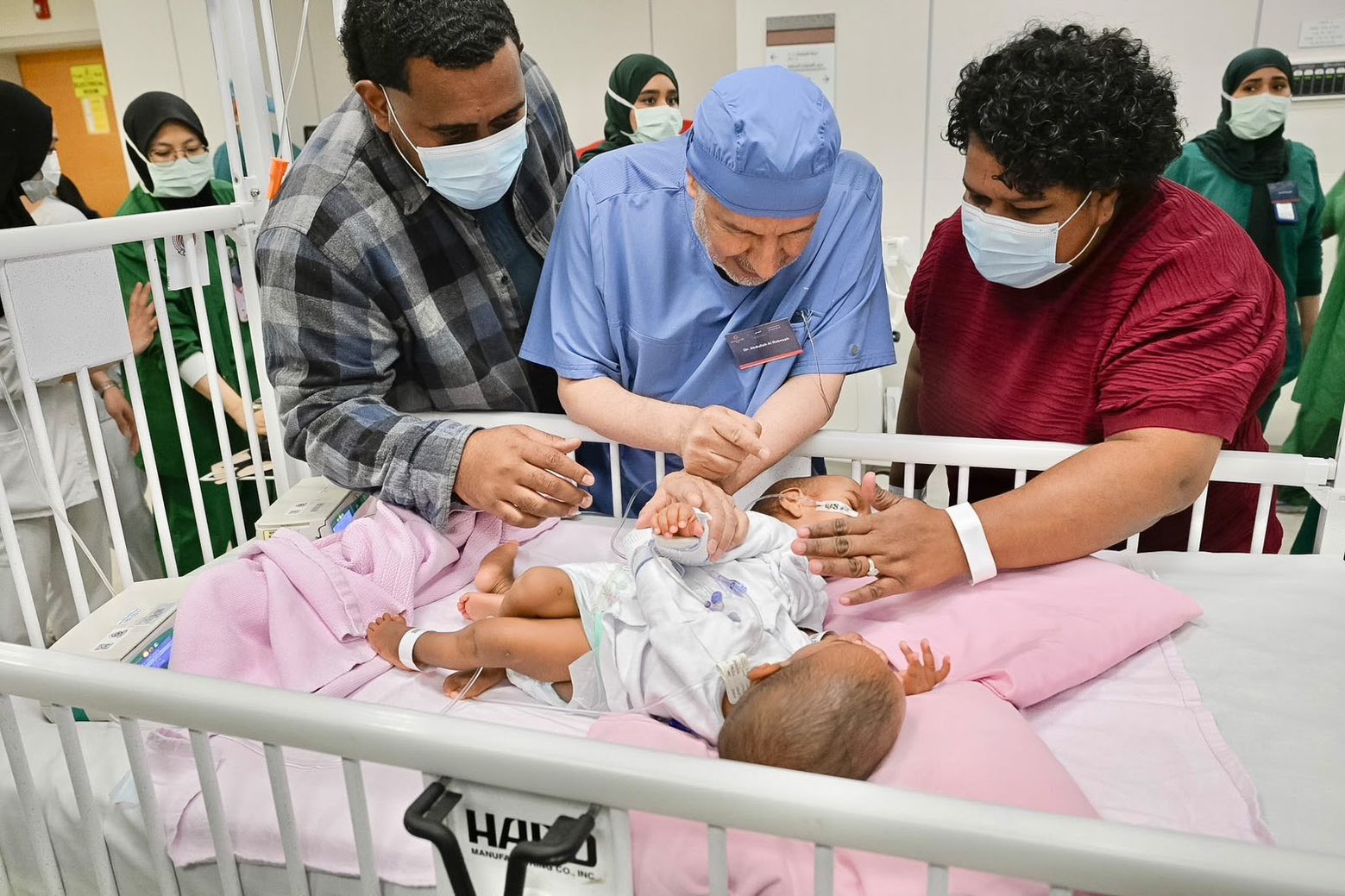 بدء عملية فصل التوأم الملتصق الفيجي "جسبيلي وديسيسيا"