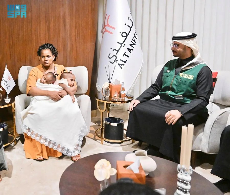 عملية جديدة لفصل توأم تنزاني في الرياض