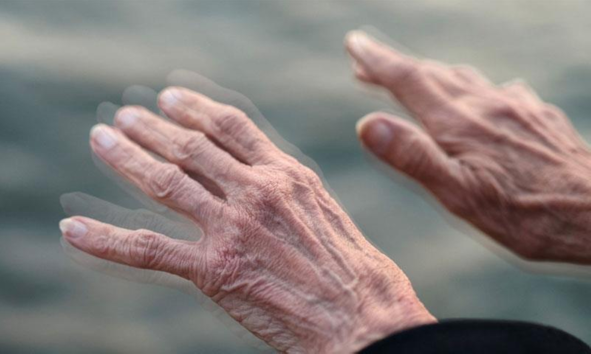 اليوم العالمي لشلل الرعاش.. 3 أعراض للإصابة ولهذا السبب سُمّي بـ"باركنسون"