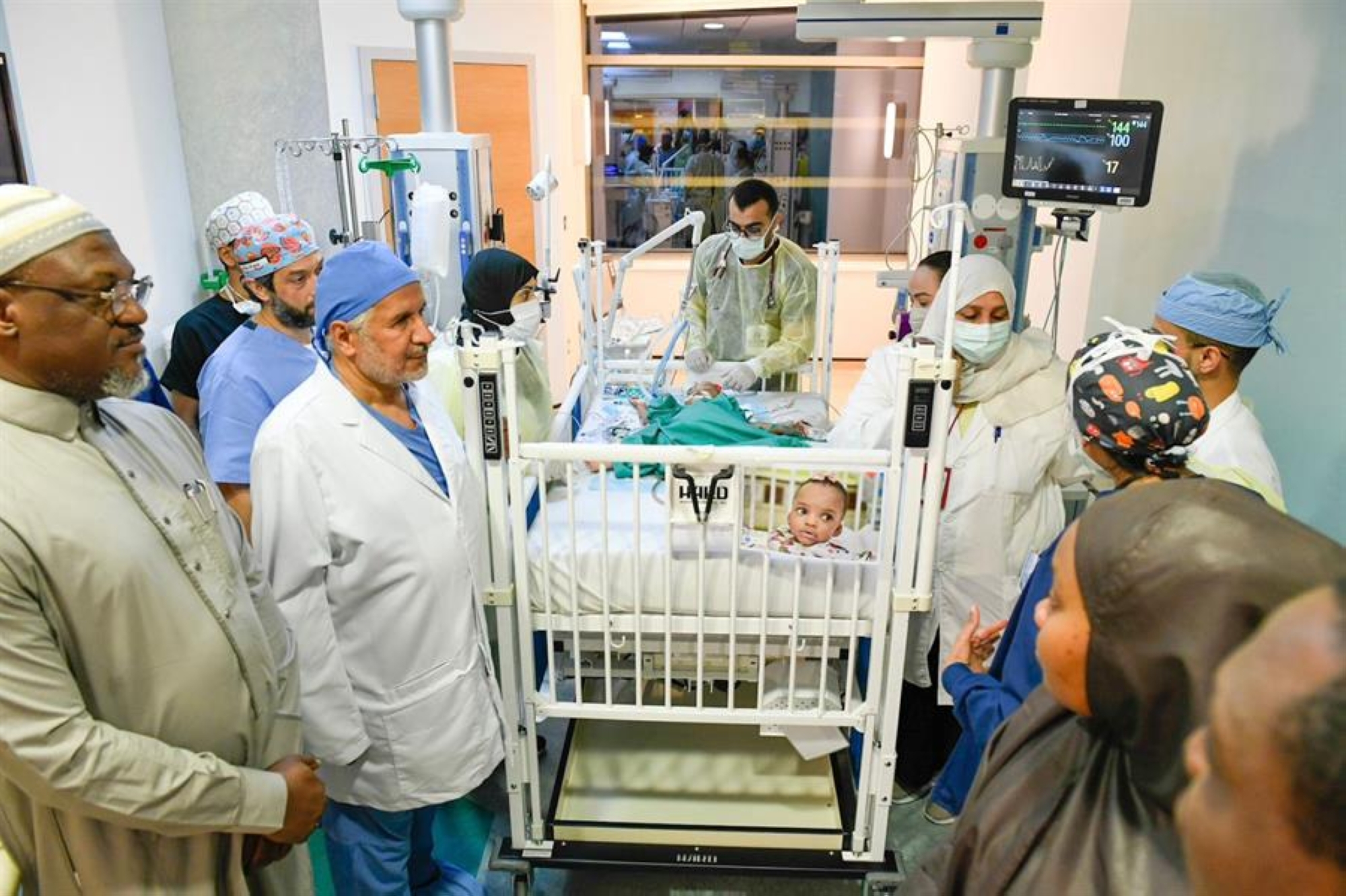 نجاح فصل التوأم السيامي النيجيري بعد جراحة معقدة استغرقت 14 ساعة