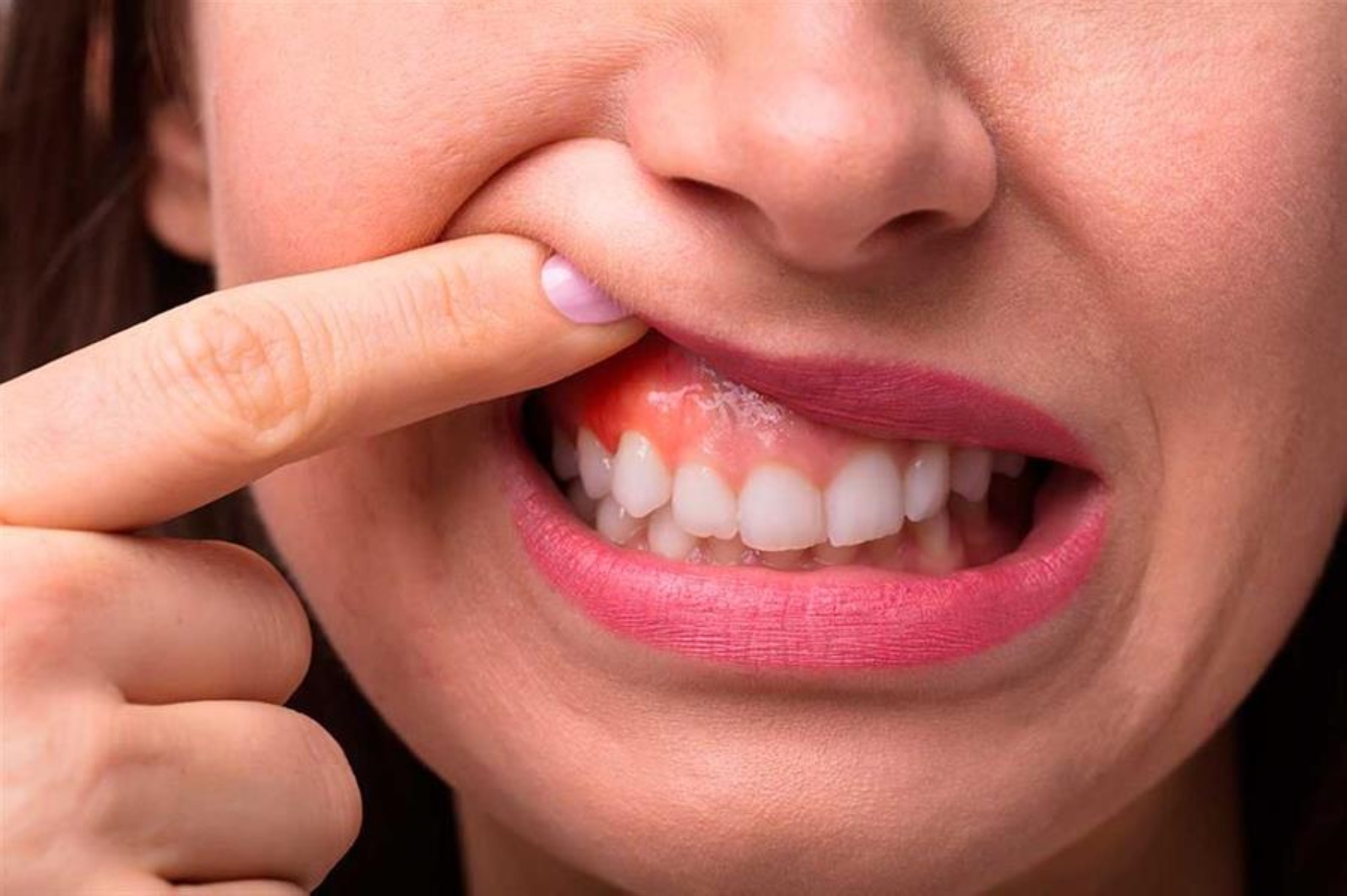 هل تهمل لثتك؟ 6 أسباب للاهتمام بنظافة فمك أحدها مهم للحوامل