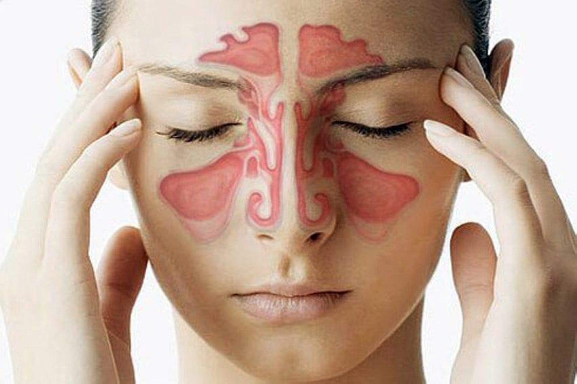 4 أعراض لصداع الجيوب الأنفية.. وهذه طرق الوقاية منه