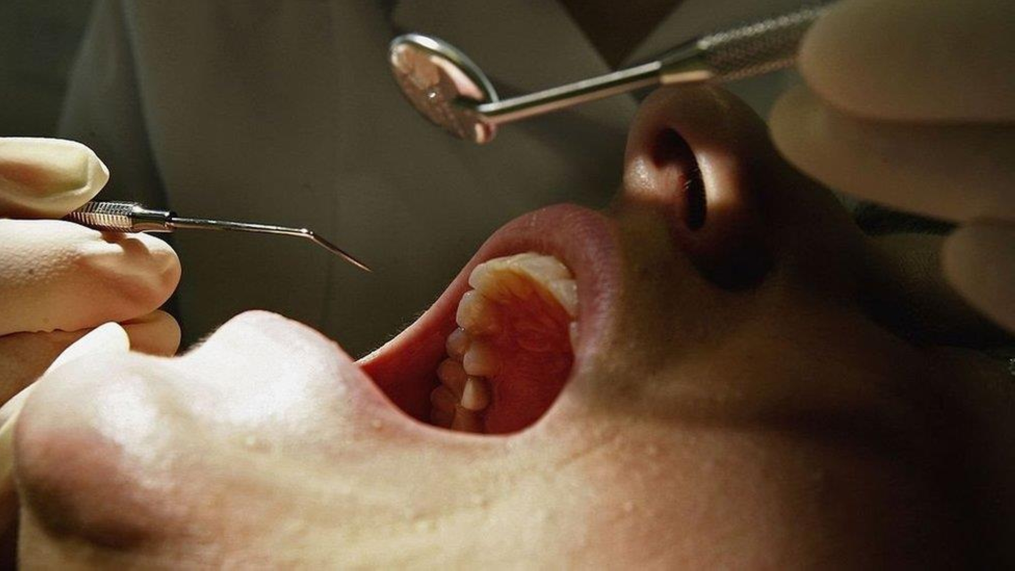 علماء يقتربون من علاج غير مسبوق يتيح للأسنان النمو مرة أخرى