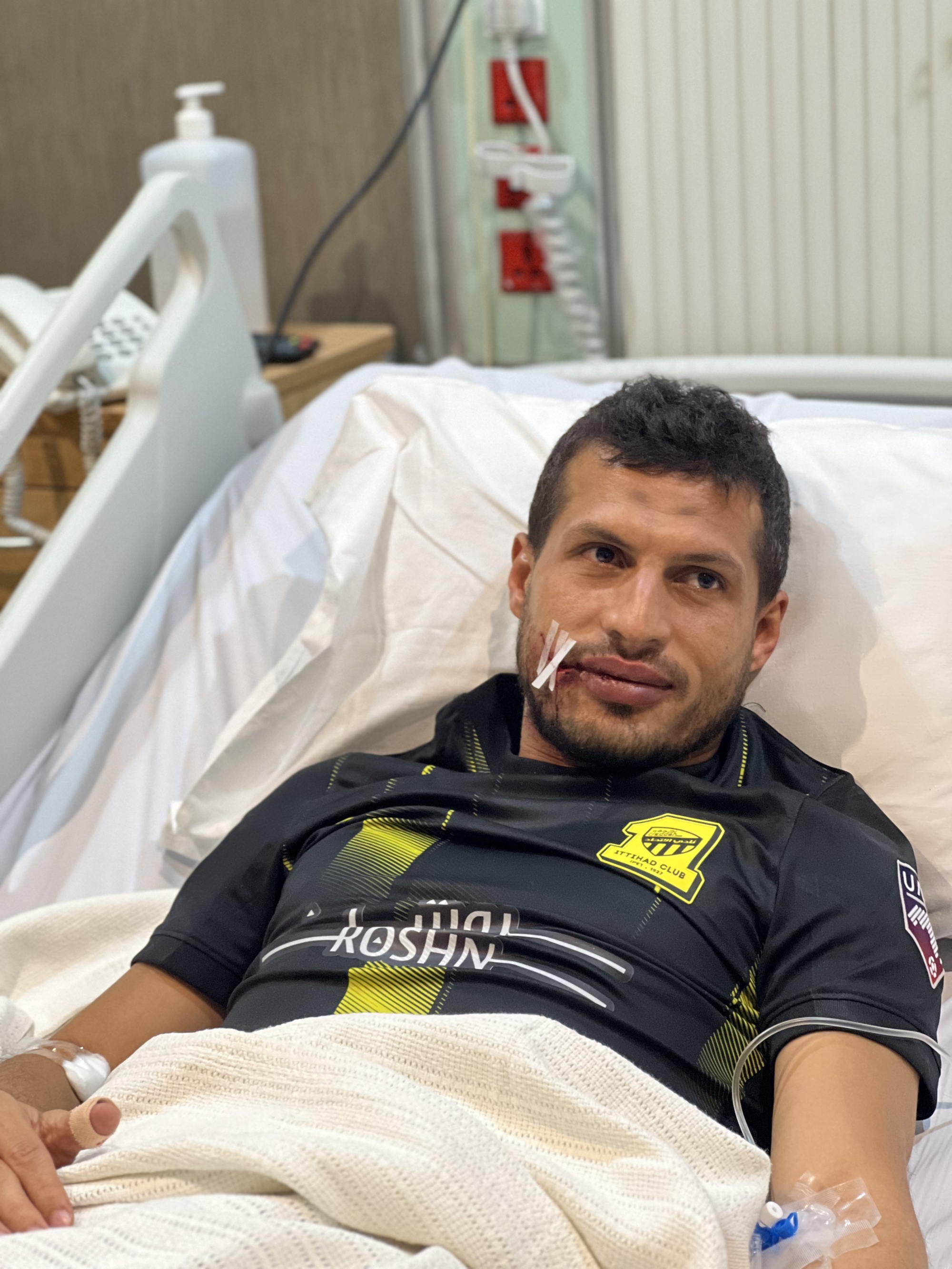 طارق حامد يجري جراحة ناجحة في الوجه