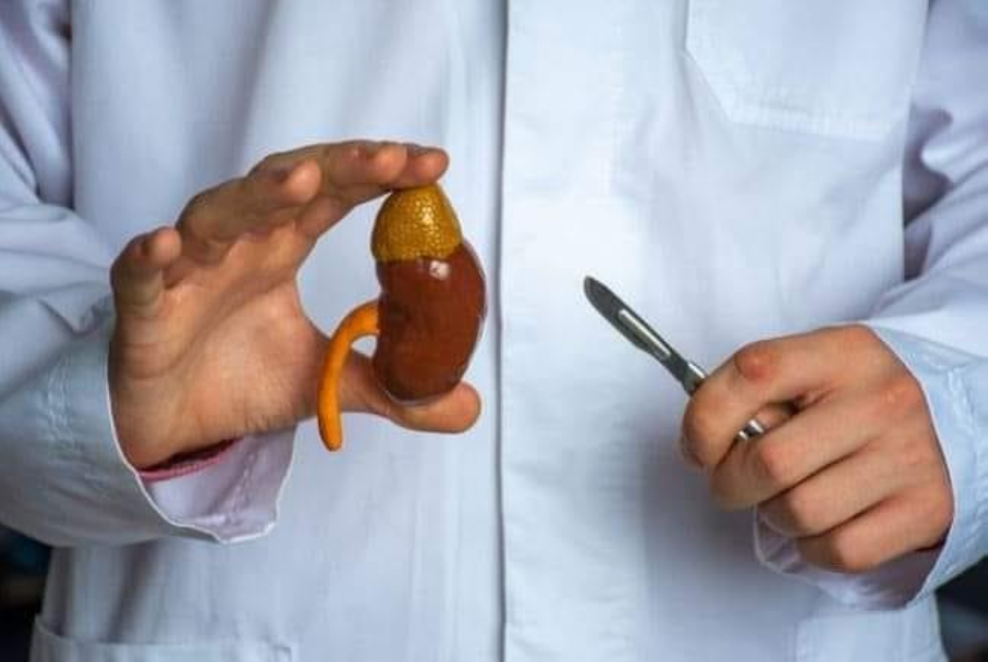 "دراسة" تكشف سبب "سرطان الكلى"