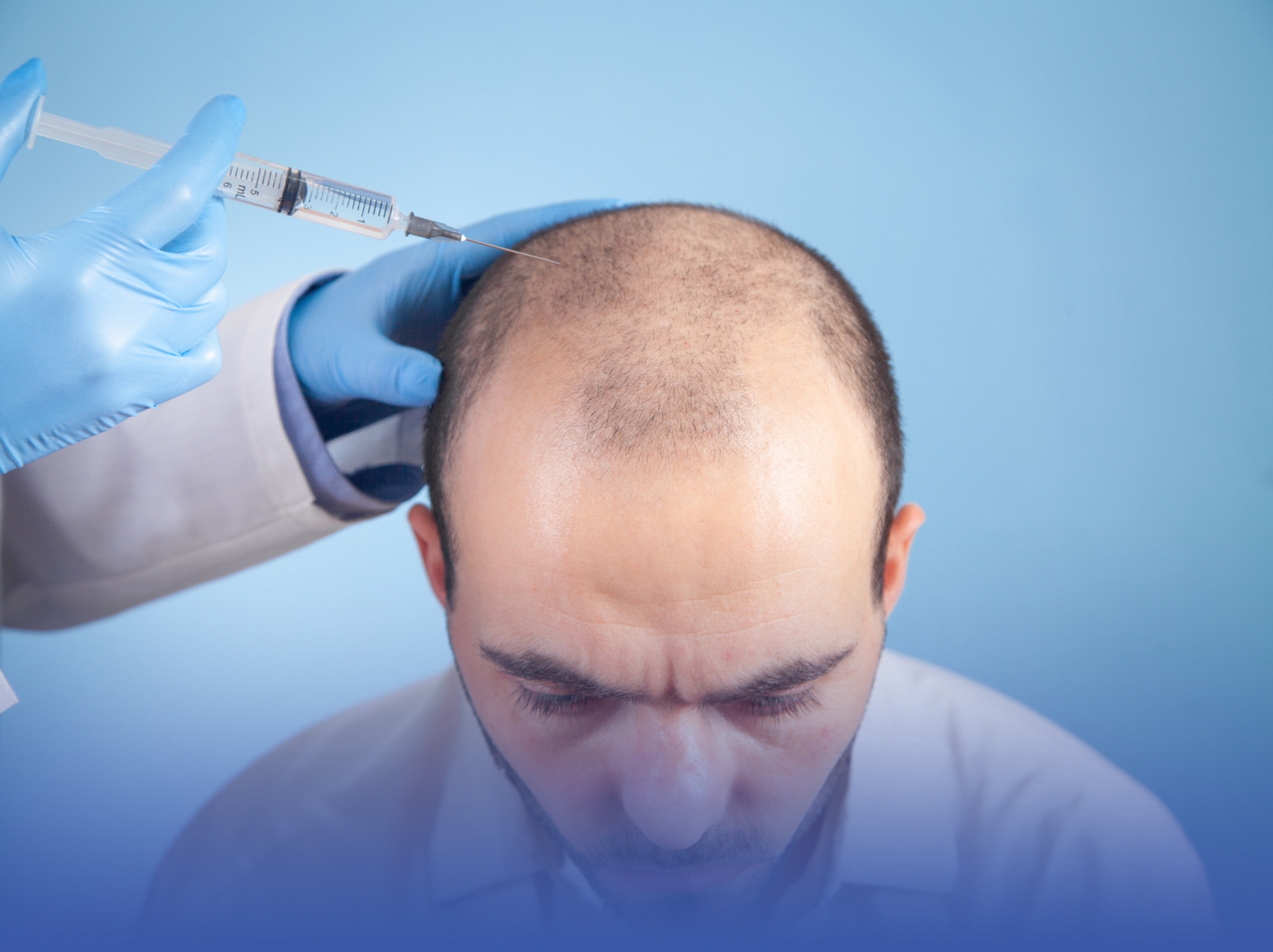 "مخاوف" تُطارد "زراعة" الشعر
