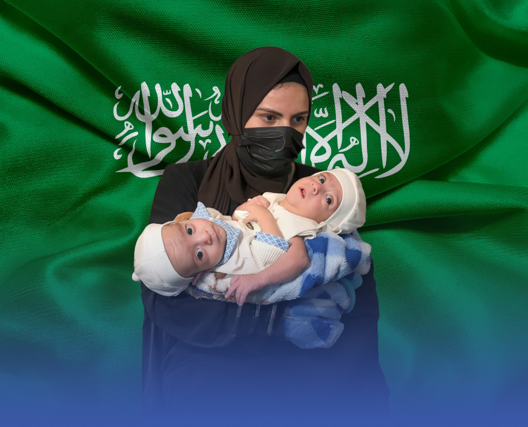 مؤتمر دولي لعرض مسيرة  فصل التوائم بالسعودية