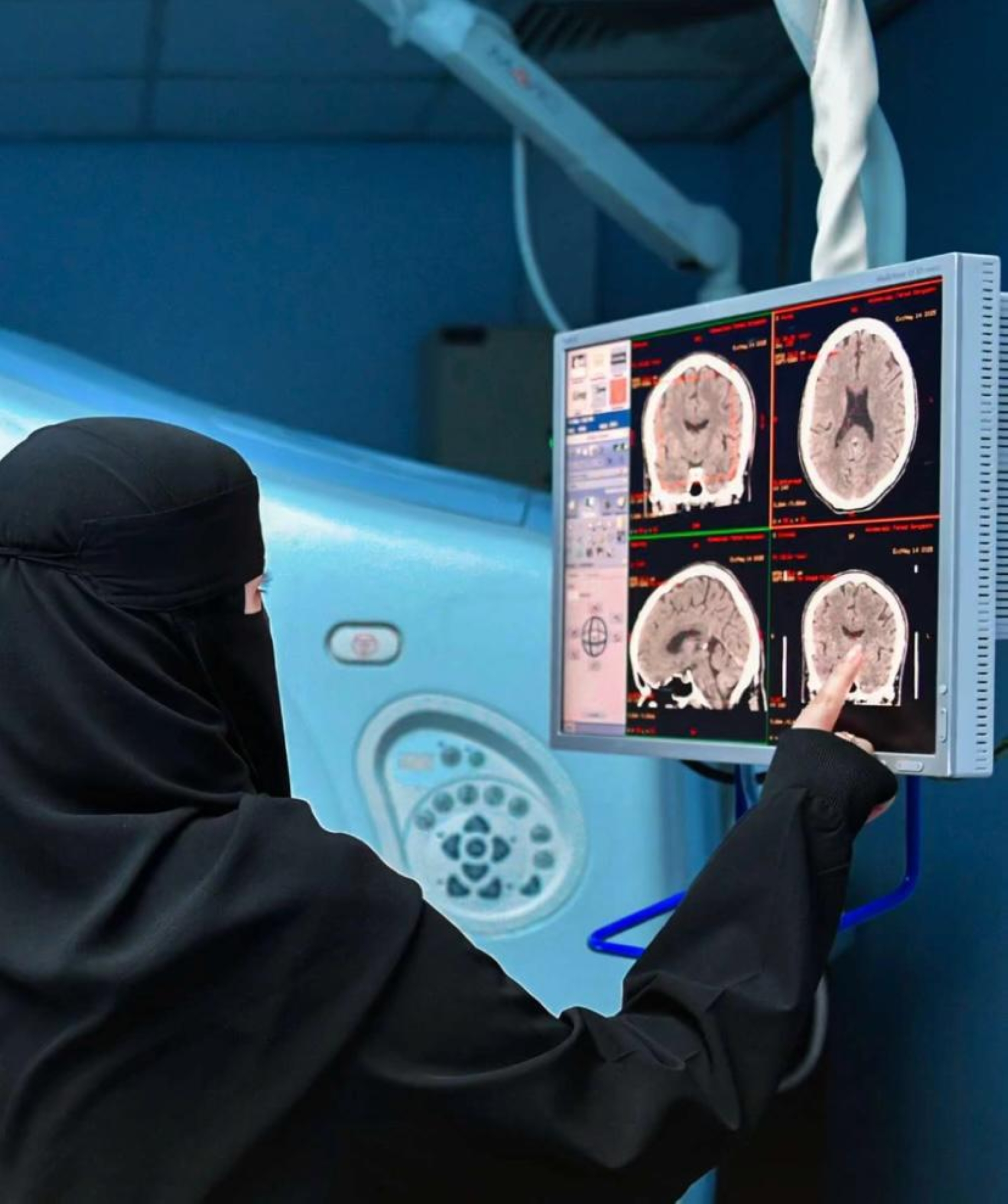بمساهمة سعودية .. اكتشاف جين نادر يؤثر على الدماغ