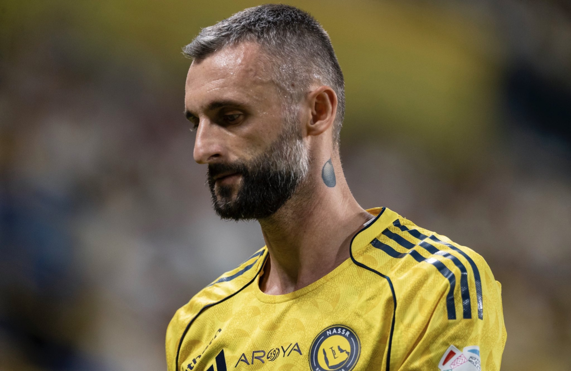 الأشعة تكشف مدة غياب بروزوفيتش عن النصر