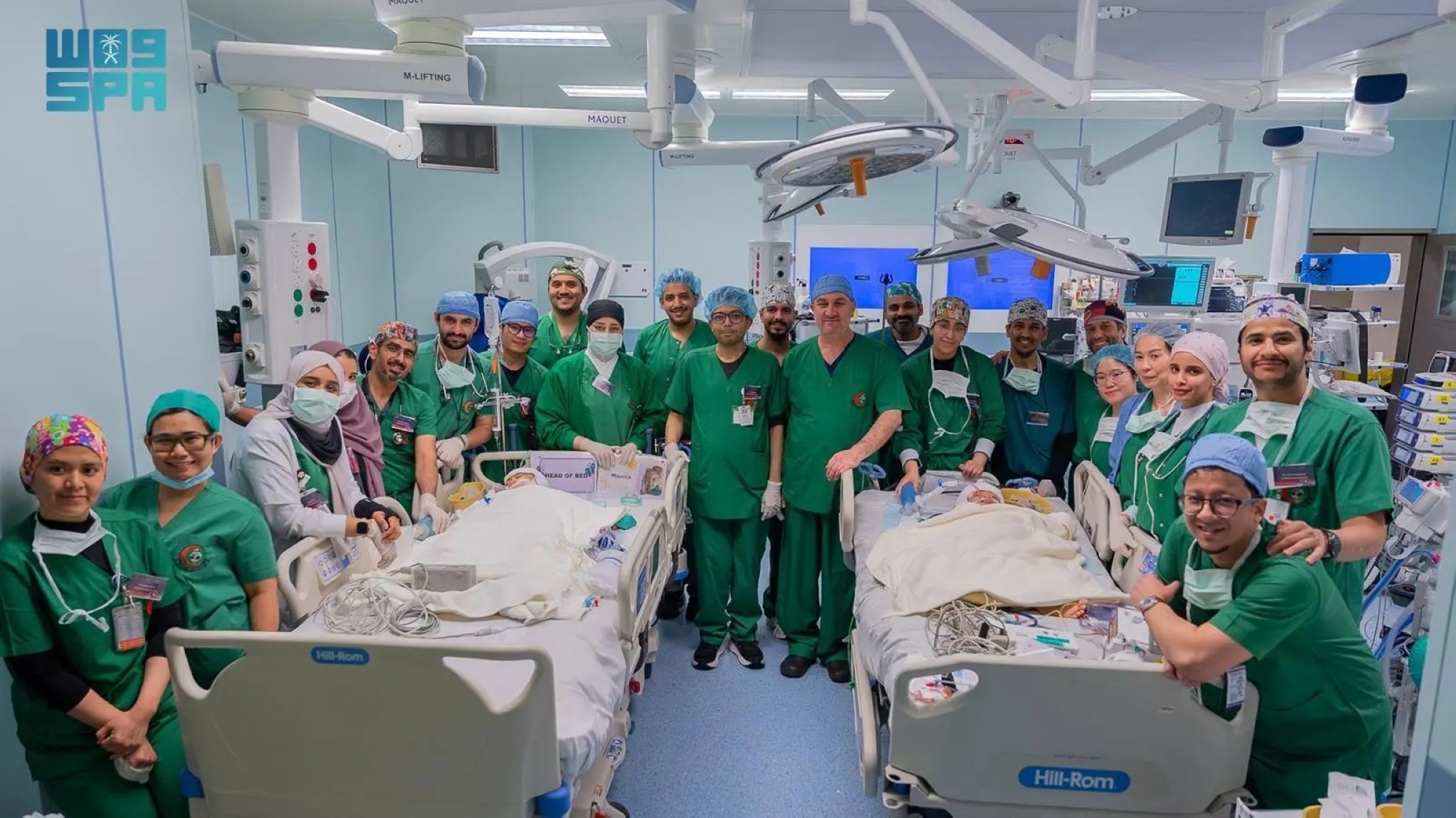 اكتمال عملية فصل التوأم الملتصق الفلبيني "كليا وموريس آن"