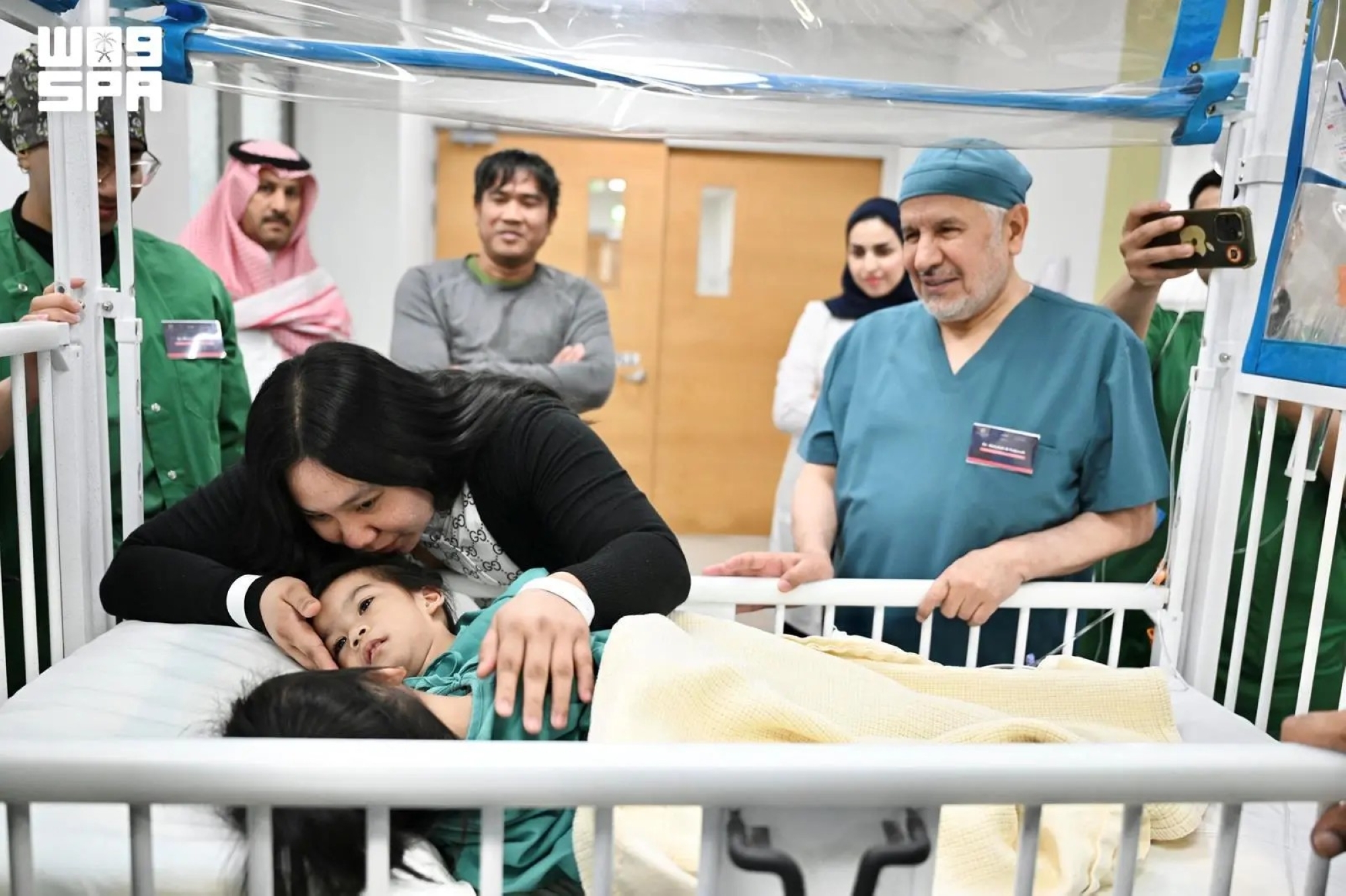 نجاح عملية فصل التوأم الفلبيني "جيانا وأوليفيا"