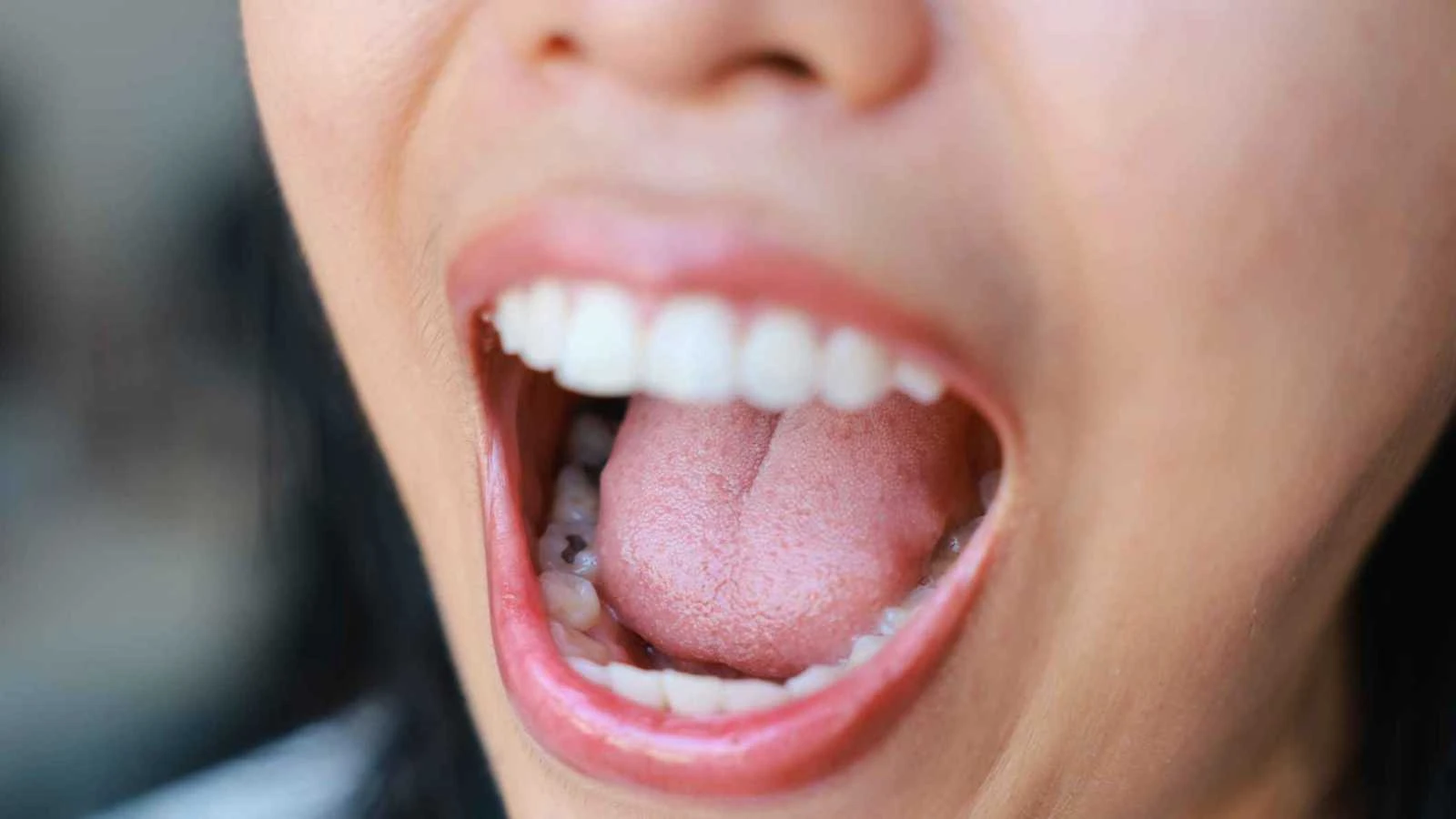 بكتيريا اللسان ترتبط بسرعة معالجة المعلومات في الدماغ