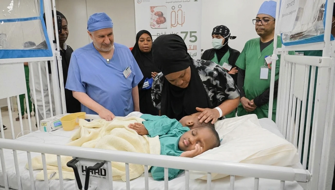 بدء عملية فصل التوأم الملتصق التنزاني "لايتيينس ولوفنس" في الرياض