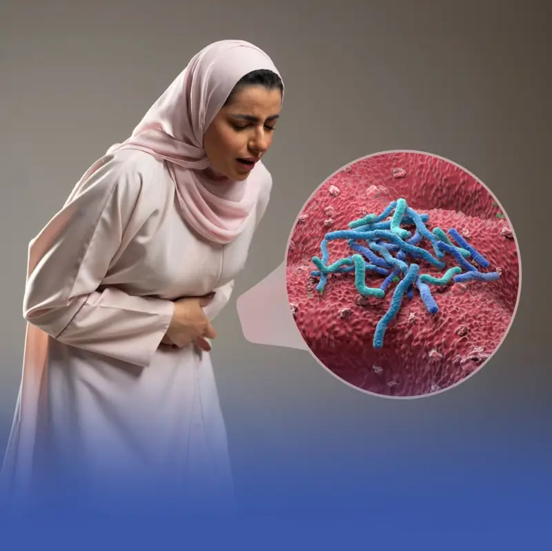 أعراضها خادعة.. "جرثومة المعدة" ومخاطر التشخيص الذاتي