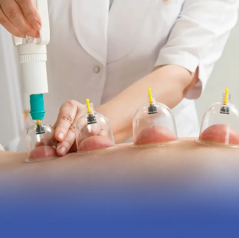 "الطب البديل" يحذر من استخدام العسل في الحجامة