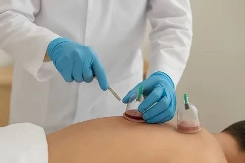 الصحة: الحجامة ليست علاجًا مثبتًا للصدفية